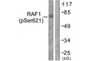 Western blot analysis of extracts from HeLa cells treated with UV 5', using C-RAF (Phospho-Ser621) Antibody.