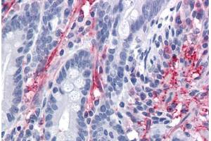 Human Small Intestine: Formalin-Fixed, Paraffin-Embedded (FFPE) (MYOC Antikörper  (AA 36-135))