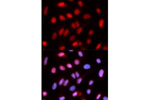 Immunofluorescence analysis of U2OS cells using RFC4 antibody. (RFC4 Antikörper)