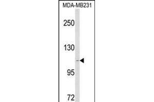 Western blot analysis of CARD6 Antibody (Center) (ABIN1881136 and ABIN2842626) in MDA-M cell line lysates (35 μg/lane). (CARD6 Antikörper  (AA 755-787))