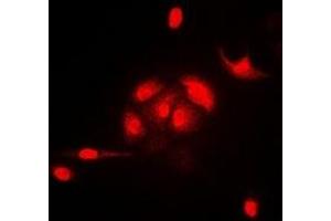 Immunofluorescent analysis of HEMK2 staining in A549 cells. (N6AMT1 Antikörper)