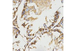Immunohistochemistry (IHC) image for anti-Low Density Lipoprotein Receptor-Related Protein Associated Protein 1 (LRPAP1) antibody (ABIN1680715) (LRPAP1 Antikörper)