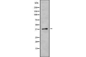 Western blot analysis of CGRRF1 using K562 whole cell lysates (CGR19 Antikörper  (Internal Region))