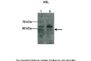 Lanes:  Lane1: 10 ug COS-7 cell lysate Lane2: 10 ug bovine aortic endothelial cell lysate Primary Antibody Dilution:  1:1000 Secondary Antibody:  Anti-rabbit HRP Secondary Antibody Dilution:  1:2000 Gene Name:  Asl Submitted by:  Shawn Elms. (ASL Antikörper  (C-Term))