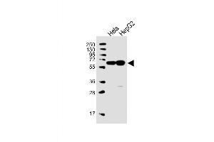 Western Blot at 1:1000 dilution Lane 1: Hela whole cell lysate Lane 2: HepG2 whole cell lysate Lysates/proteins at 20 ug per lane.