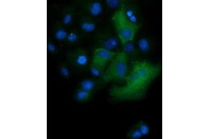 Image no. 3 for anti-Tripartite Motif Containing 38 (TRIM38) (AA 1-265) antibody (ABIN1490682) (TRIM38 Antikörper  (AA 1-265))