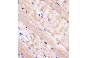 Immunohistochemistry (Paraffin-embedded Sections) (IHC (p)) image for anti-RAB7A, Member RAS Oncogene Family (RAB7A) (AA 176-204), (C-Term) antibody (ABIN652609)