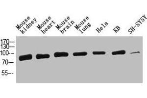 Western Blot analysis of mouse-kidney mouse-heart mouse-brain mouse-lung Hela KB SH-SY5Y cells using HSP70 Polyclonal Antibody diluted at 1:2000. (HSP70 1A Antikörper  (AA 561-610))