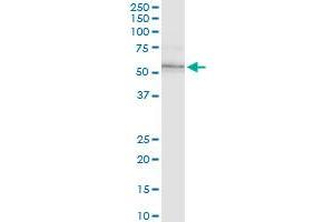 Western Blotting (WB) image for anti-Integrin-Linked Kinase (ILK) (AA 341-452) antibody (ABIN561483)