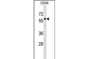 MSL3 Antibody (N-term) (ABIN1539253 and ABIN2849308) western blot analysis in CEM cell line lysates (35 μg/lane). (MSL3 Antikörper  (N-Term))
