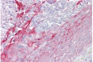 Anti-CFP / Properdin antibody IHC staining of human tonsil. (CFP Antikörper  (AA 35-84))