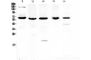 Western blot analysis of TRAF3 using anti-TRAF3 antibody .