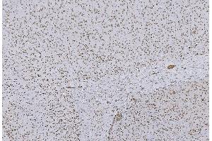 IHC analysis of HP1 alpha/CBX5 using anti-HP1 alpha/CBX5 antibody (ABIN7599057). (CBX5 Antikörper  (AA 1-191))