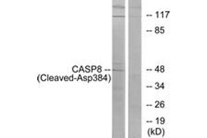 Western blot analysis of extracts from 293 cells, treated with etoposide 25uM 1h, using Caspase 8 (Cleaved-Asp384) Antibody. (Caspase 8 Antikörper  (Cleaved-Asp384))
