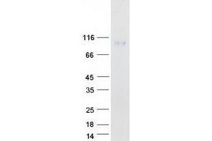 Western Blotting (WB) image for CD96 (CD96) (Transcript Variant 1) protein (Myc-DYKDDDDK Tag) (ABIN2713815)