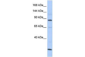 Western Blotting (WB) image for anti-MutS Homolog 5 (MSH5) antibody (ABIN2458577) (MSH5 Antikörper)