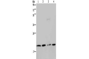 Gel: 10 % SDS-PAGE, Lysate: 40 μg, Lane 1-4: Jurkat cells, K562 cells, PC3 cells, A549 cells, Primary antibody: ABIN7130206(MCTS1 Antibody) at dilution 1/200, Secondary antibody: Goat anti rabbit IgG at 1/8000 dilution, Exposure time: 3 minutes (MCTS1 Antikörper)