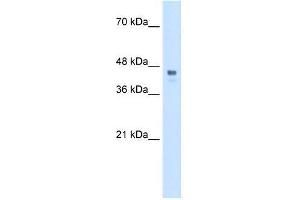 Transfected 293T; WB Suggested Anti-HOXC10 Antibody Titration: 0. (HOXC10 Antikörper  (Middle Region))