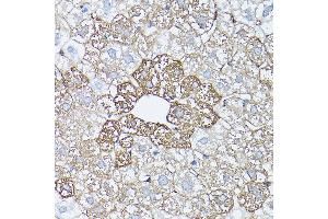 Immunohistochemistry of paraffin-embedded rat liver using [KO Validated] Glutamine Synthetase (Glutamine Synthetase (GLUL)) Rabbit pAb (ABIN6130425, ABIN6141161, ABIN6141162 and ABIN7101772) at dilution of 1:150 (40x lens). (GLUL Antikörper  (AA 1-373))