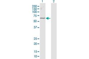 Western Blot analysis of ARRB1 expression in transfected 293T cell line by ARRB1 MaxPab polyclonal antibody. (beta Arrestin 1 Antikörper  (AA 1-418))