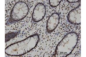 Image no. 3 for anti-High-Mobility Group 20A (HMG20A) (AA 153-263) antibody (ABIN599514) (HMG20A Antikörper  (AA 153-263))