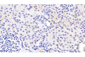 Detection of LAMa3 in Human Kidney Tissue using Polyclonal Antibody to Laminin Alpha 3 (LAMa3) (LAMA3 Antikörper  (AA 47-296))