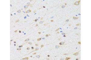 Immunohistochemistry of paraffin-embedded Rat brain using CHRM5 Polyclonal Antibody at dilution of 1:100 (40x lens). (CHRM5 Antikörper)