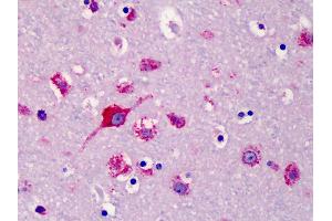 Anti-SLC35D1 antibody IHC of human brain, cortex. (SLC35D1 Antikörper  (N-Term))