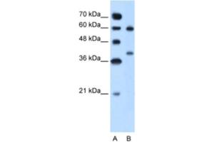 Western Blotting (WB) image for anti-Arginase, Liver (ARG1) antibody (ABIN2462876) (Liver Arginase Antikörper)