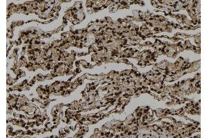 ABIN6273321 at 1/100 staining Human lung tissue by IHC-P. (SMYD3 Antikörper  (N-Term))