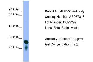 WB Suggested Anti-RAB5C  Antibody Titration: 0. (Rab5c Antikörper  (Middle Region))