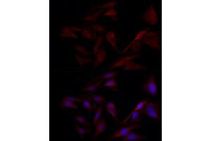 Immunofluorescence analysis of U2OS cells using TYK2 Rabbit pAb (ABIN3022987, ABIN3022988, ABIN3022989 and ABIN6219333) at dilution of 1:150 (40x lens). (TYK2 Antikörper  (AA 750-850))