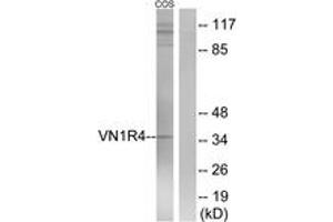 VN1R4 antibody  (AA 88-137)