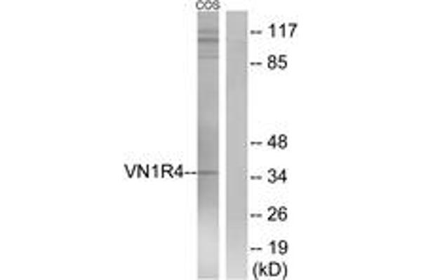 VN1R4 antibody  (AA 88-137)
