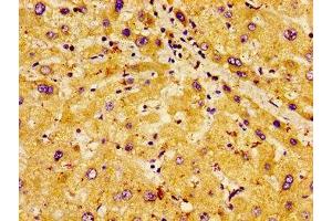 Immunohistochemistry of paraffin-embedded human liver tissue using ABIN7163666 at dilution of 1: 100 (PHLDA1 Antikörper  (AA 1-138))