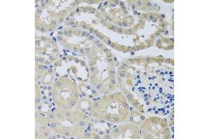 Immunohistochemistry of paraffin-embedded mouse kidney using CHMP1B antibody at dilution of 1:100 (x40 lens). (CHMP1B Antikörper)