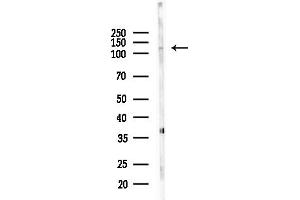 anti-Myosin IF (MYO1F) (Internal Region) antibody