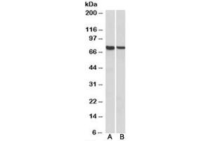 Western blot testing of mouse [A] and rat [B] spleen lysates with MUNC18-3 antibody at 1ug/ml. (STXBP3 Antikörper)