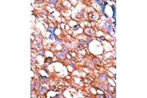 Image no. 2 for anti-V-Erb-A erythroblastic Leukemia Viral Oncogene Homolog 4 (Avian) (ERBB4) (pTyr1162) antibody (ABIN358139) (ERBB4 Antikörper  (pTyr1162))