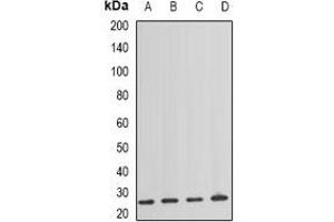 Western blot analysis of NAT8 expression in HEK293T (A), mouse spleen (B), mouse lung (C), rat kidney (D) whole cell lysates. (NAT8 Antikörper)