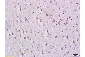 Formalin-fixed and paraffin embedded rat brain tissue labeled with Rabbit Anti-GABRA1 Polyclonal Antibody, Unconjugated (ABIN703796) at 1:200 followed by conjugation to the secondary antibody and DAB staining (GABRA1 Antikörper  (AA 351-456))
