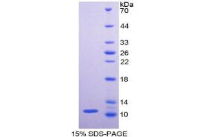 SDS-PAGE analysis of Human PKM2 Protein. (PKM Protein)