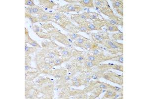 Immunohistochemistry of paraffin-embedded human liver using NUDT15 antibody at dilution of 1:100 (40x lens). (NUDT15 Antikörper)