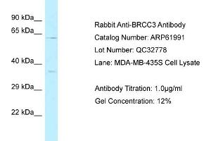 Western Blotting (WB) image for anti-BRCA1/BRCA2-Containing Complex, Subunit 3 (BRCC3) (C-Term) antibody (ABIN2788977) (BRCC3 Antikörper  (C-Term))