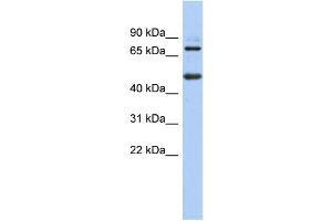 WB Suggested Anti-ZBTB26 Antibody Titration:  0. (ZBTB26 Antikörper  (N-Term))