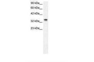 Image no. 2 for anti-Nucleophosmin (Nucleolar phosphoprotein B23, Numatrin) (NPM1) (N-Term) antibody (ABIN202181) (NPM1 Antikörper  (N-Term))