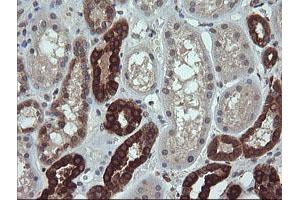 Image no. 2 for anti-RAB21, Member RAS Oncogene Family (RAB21) antibody (ABIN1500545) (RAB21 Antikörper)