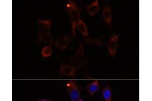 Immunofluorescence analysis of NIH/3T3 cells using YTHDC2 Polyclonal Antibody at dilution of 1:100. (YTHDC2 Antikörper)