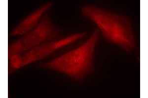 Immunofluorescence staining of methanol-fixed Hela cells using Phospho-G3BP1-S232 antibody. (G3BP1 Antikörper  (pSer232))