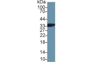 Detection of TNNT1 in Mouse Skeletal muscle lysate using Polyclonal Antibody to Troponin T Type 1, Slow Skeletal (TNNT1) (TNNT1 Antikörper  (AA 1-259))